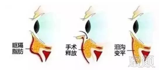https://img.miyanlife.com/mnt/timg/181026/12101V260-2.jpg