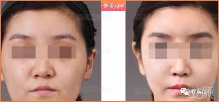 https://img.miyanlife.com/mnt/timg/181026/1211314252-15.jpg