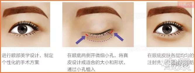 https://img.miyanlife.com/mnt/timg/181026/1211315323-10.jpg