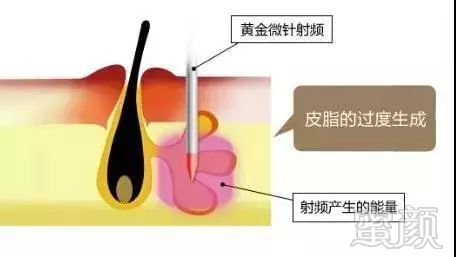 案例图片