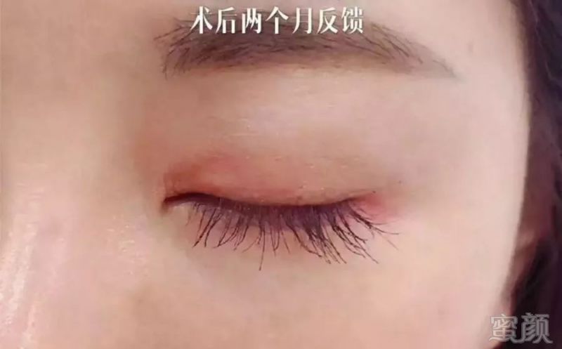https://img.miyanlife.com/mnt/timg/181026/1313204C4-2.jpg
