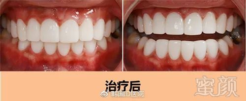 https://img.miyanlife.com/mnt/timg/181026/132KG933-2.jpg