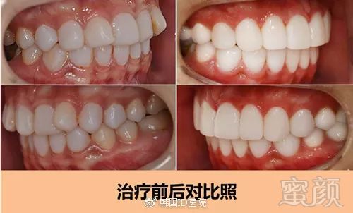 https://img.miyanlife.com/mnt/timg/181026/132KKU8-3.jpg