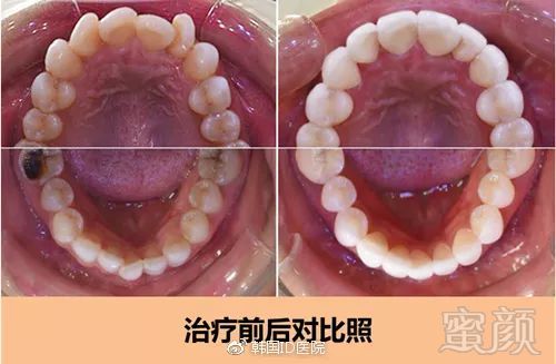 https://img.miyanlife.com/mnt/timg/181026/132KWC1-4.jpg