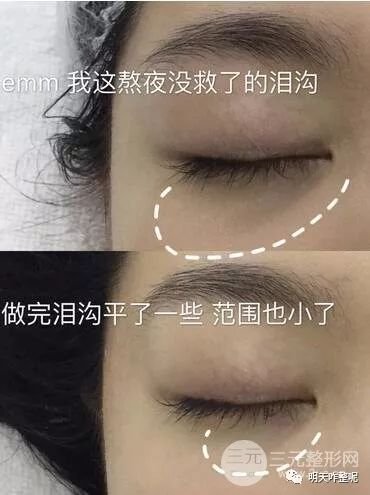 https://img.miyanlife.com/mnt/timg/181027/1239511135-4.jpg