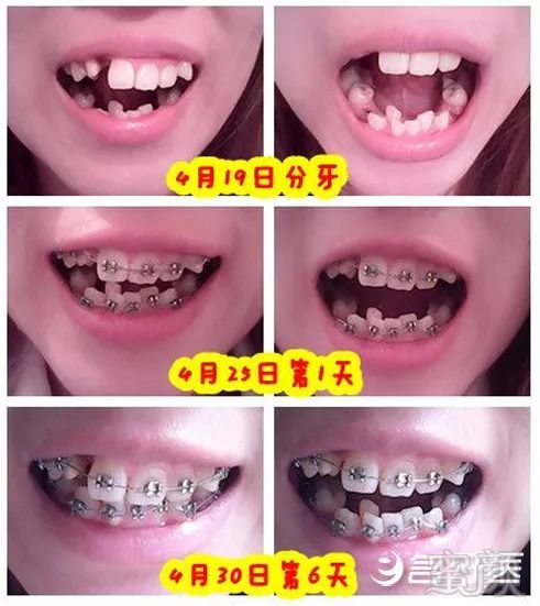 https://img.miyanlife.com/mnt/timg/181027/12402114R-4.jpg