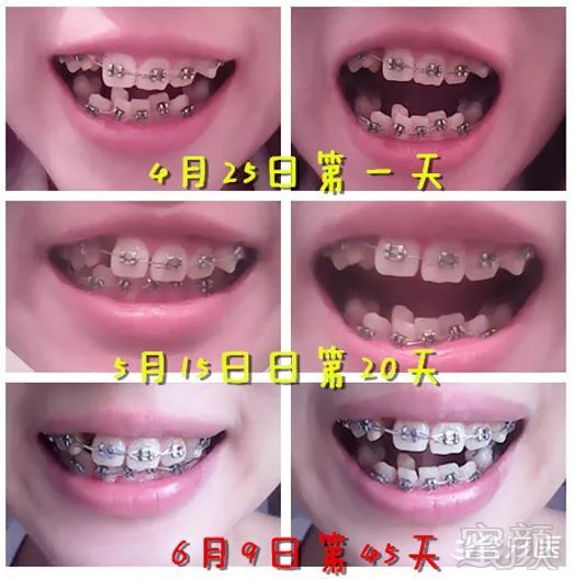 https://img.miyanlife.com/mnt/timg/181027/1240211924-5.jpg