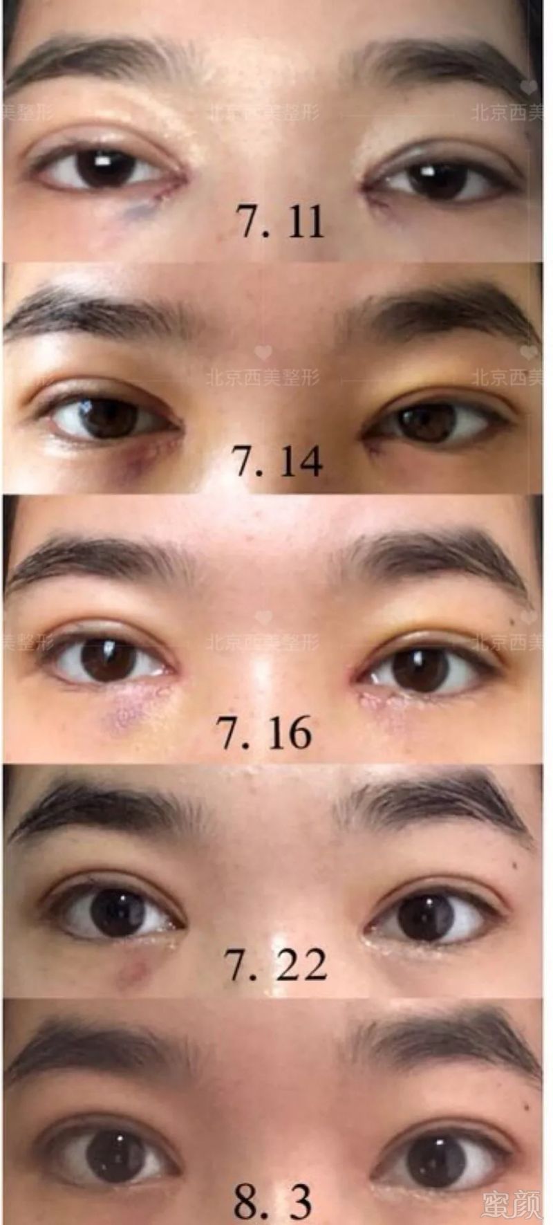 https://img.miyanlife.com/mnt/timg/181027/1244003P5-5.jpg