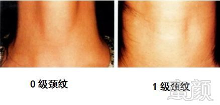 https://img.miyanlife.com/mnt/timg/181027/124G023S-3.jpg