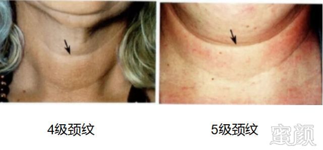 https://img.miyanlife.com/mnt/timg/181027/124G0A60-5.jpg