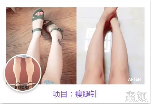 https://img.miyanlife.com/mnt/timg/181027/12530C3Y-10.jpg