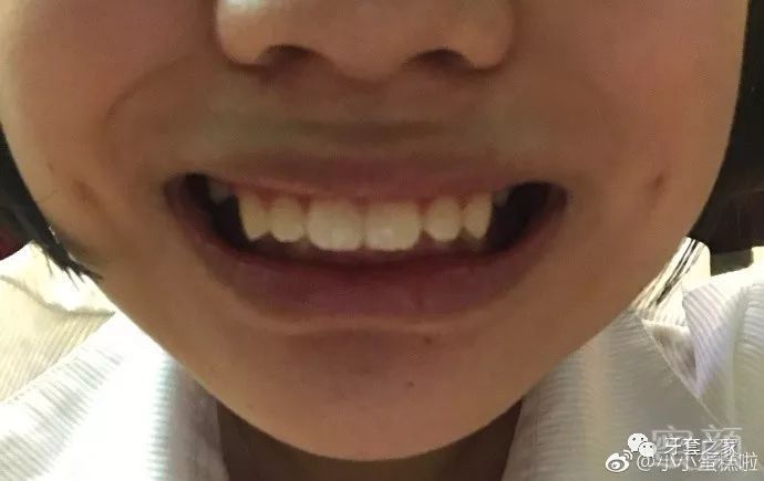 https://img.miyanlife.com/mnt/timg/181027/1323251356-1.jpg