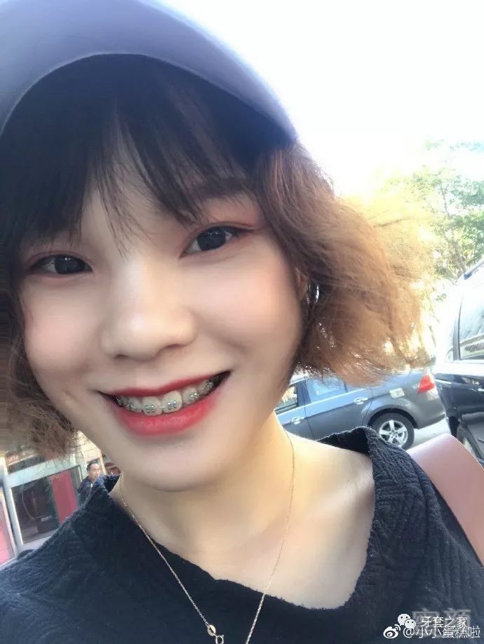 https://img.miyanlife.com/mnt/timg/181027/13232563X-5.jpg