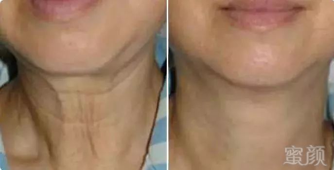 https://img.miyanlife.com/mnt/timg/181027/134201KO-12.jpg