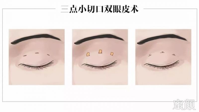 https://img.miyanlife.com/mnt/timg/181027/1352511006-3.jpg