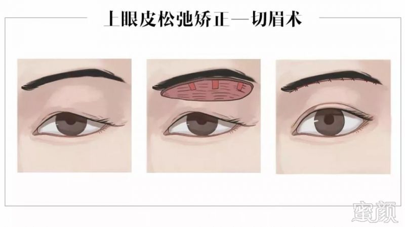 https://img.miyanlife.com/mnt/timg/181027/1352531958-14.jpg