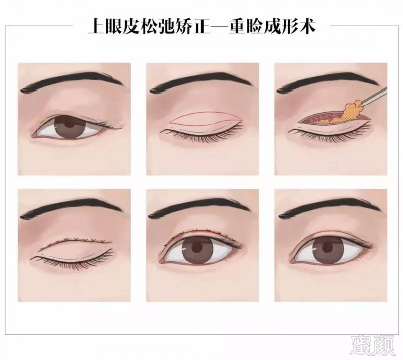 https://img.miyanlife.com/mnt/timg/181027/1352532563-13.jpg