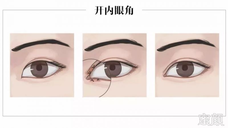 https://img.miyanlife.com/mnt/timg/181027/1352532636-11.jpg