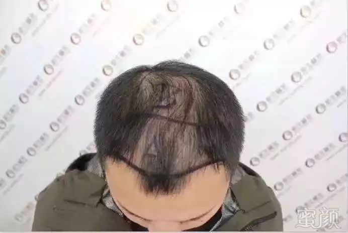 https://img.miyanlife.com/mnt/timg/181028/09114012J-0.jpg