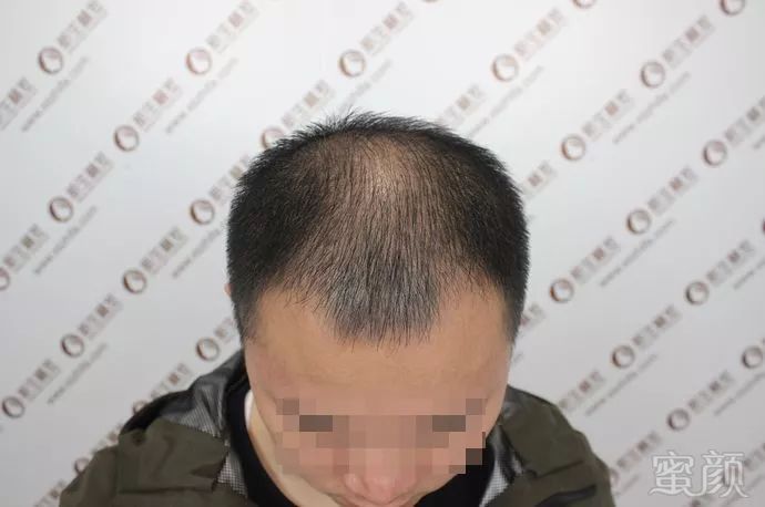 https://img.miyanlife.com/mnt/timg/181028/0911403412-2.jpg