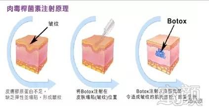 案例图片