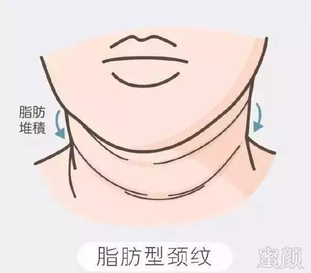https://img.miyanlife.com/mnt/timg/181029/11045a049-7.jpg