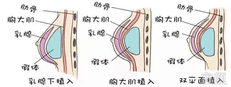 案例图片