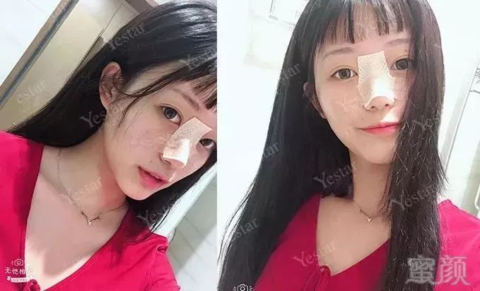 https://img.miyanlife.com/mnt/timg/181029/115PH559-14.jpg