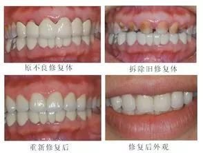 https://img.miyanlife.com/mnt/timg/181029/1205053V9-9.jpg