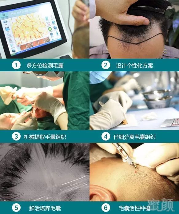 https://img.miyanlife.com/mnt/timg/181029/12054013U-3.jpg