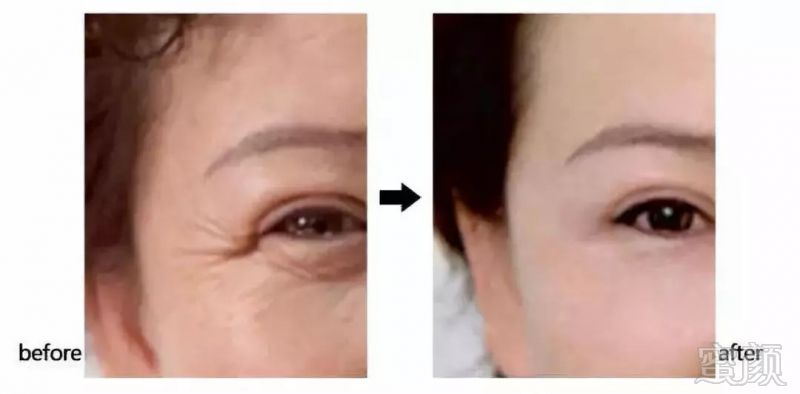 https://img.miyanlife.com/mnt/timg/181029/1211212160-10.jpg