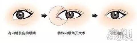 https://img.miyanlife.com/mnt/timg/181029/122TV030-2.jpg