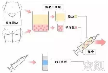 https://img.miyanlife.com/mnt/timg/181030/10452CK0-4.jpg