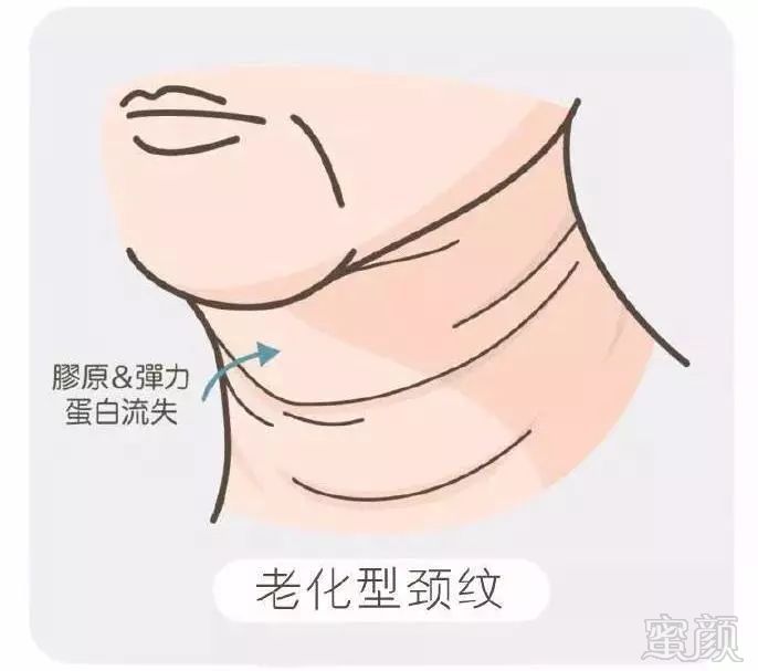https://img.miyanlife.com/mnt/timg/181030/1114041Q9-1.jpg