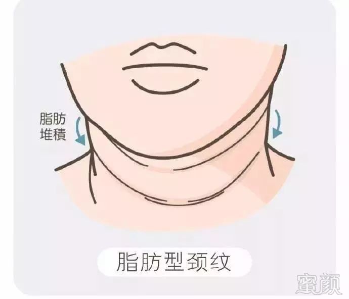 https://img.miyanlife.com/mnt/timg/181030/1114041S7-3.jpg