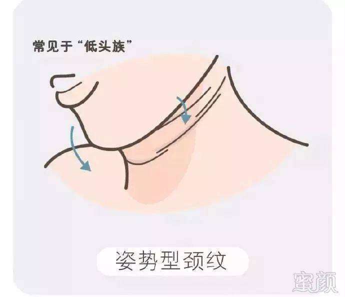 https://img.miyanlife.com/mnt/timg/181030/111404F92-2.jpg