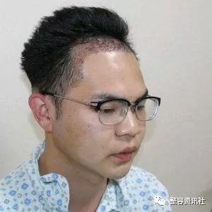 https://img.miyanlife.com/mnt/timg/181030/1133544125-0.jpg