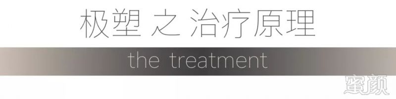 https://img.miyanlife.com/mnt/timg/181030/11405524b-12.jpg