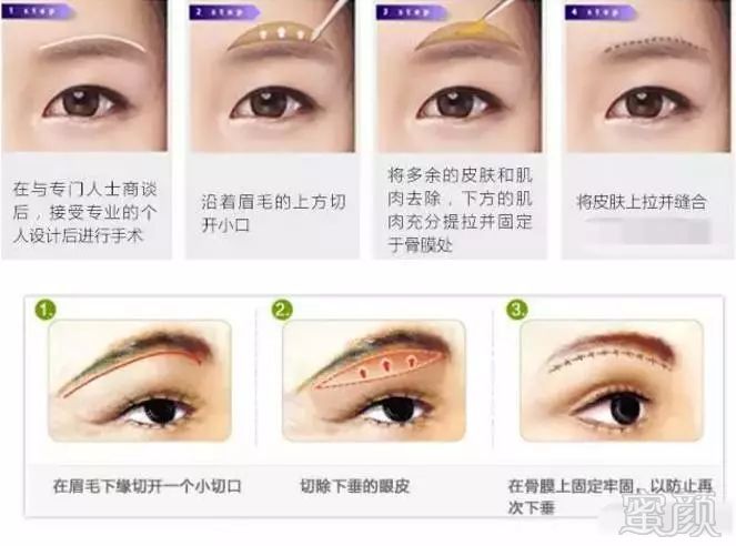 https://img.miyanlife.com/mnt/timg/181030/1159536394-4.jpg