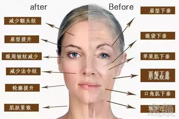 https://img.miyanlife.com/mnt/timg/181031/10414B5D-4.jpg