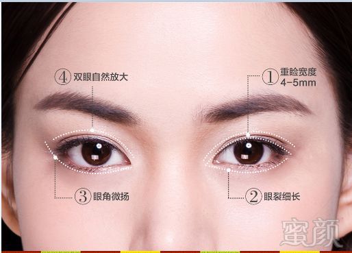 https://img.miyanlife.com/mnt/timg/181031/1133135127-4.jpg