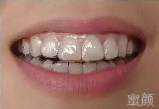 https://img.miyanlife.com/mnt/timg/181031/1153091T7-11.jpg