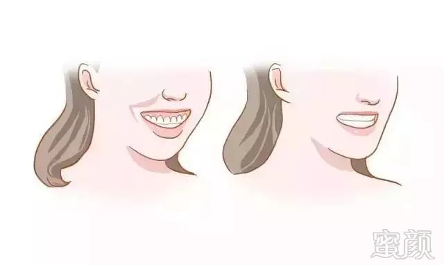 https://img.miyanlife.com/mnt/timg/181031/11530T114-5.jpg