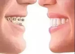 https://img.miyanlife.com/mnt/timg/181031/1153102V1-14.jpg