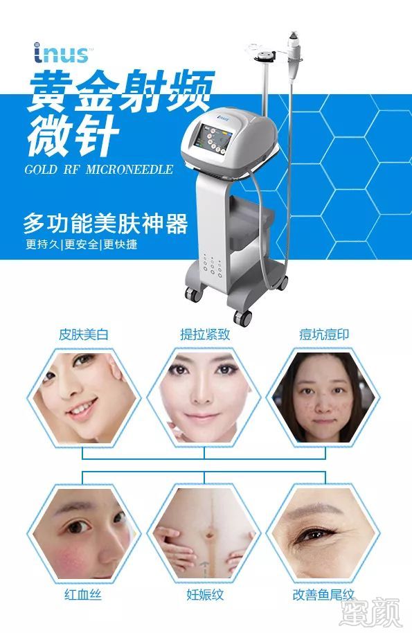 https://img.miyanlife.com/mnt/timg/181031/120A31594-0.jpg