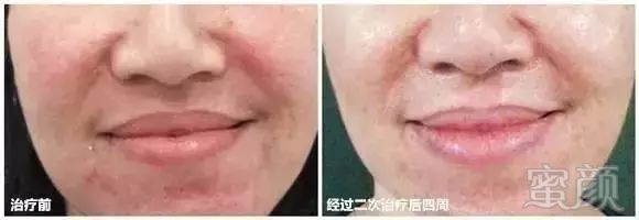 https://img.miyanlife.com/mnt/timg/181031/120A33363-5.jpg