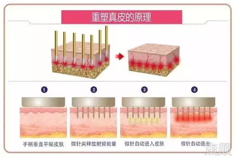 https://img.miyanlife.com/mnt/timg/181031/120A33U4-1.jpg