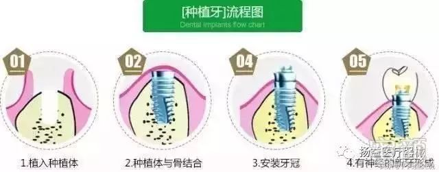 https://img.miyanlife.com/mnt/timg/181031/122I33116-2.jpg