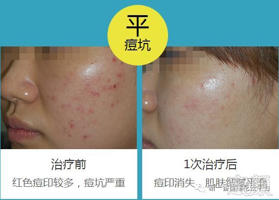 https://img.miyanlife.com/mnt/timg/181031/12325aZ2-9.jpg