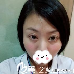 https://img.miyanlife.com/mnt/timg/181101/12434A0L-5.jpg